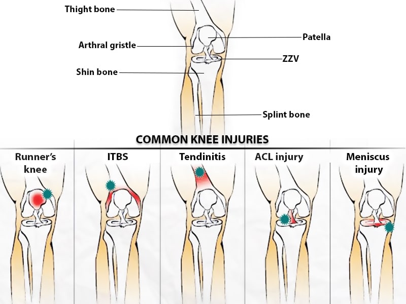 Common Injuries and Conditions of the Knee Joint