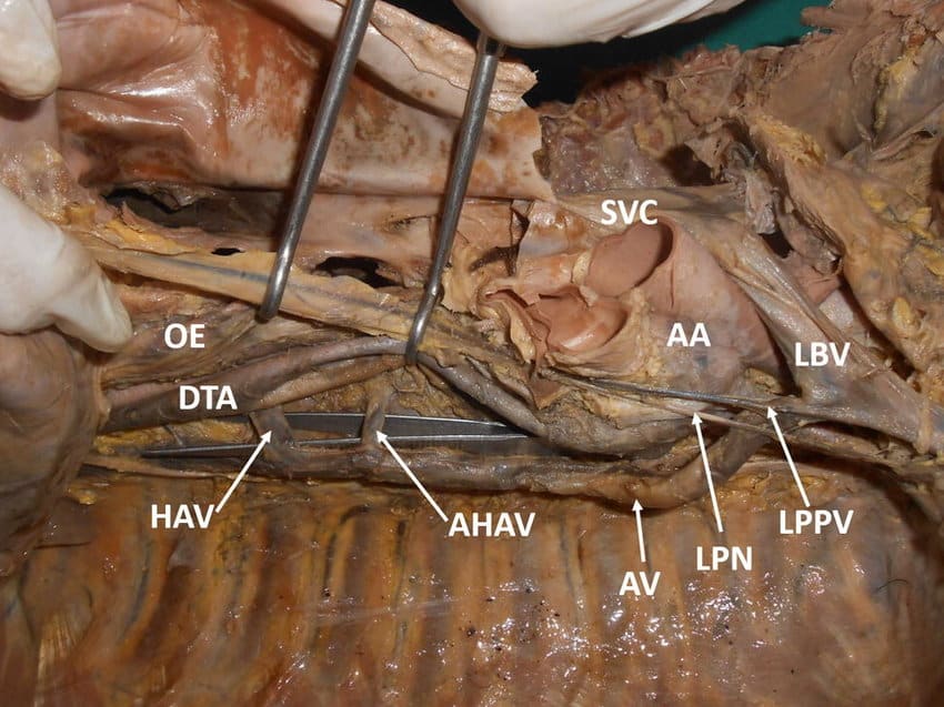Anatomy of the Azygos Vein