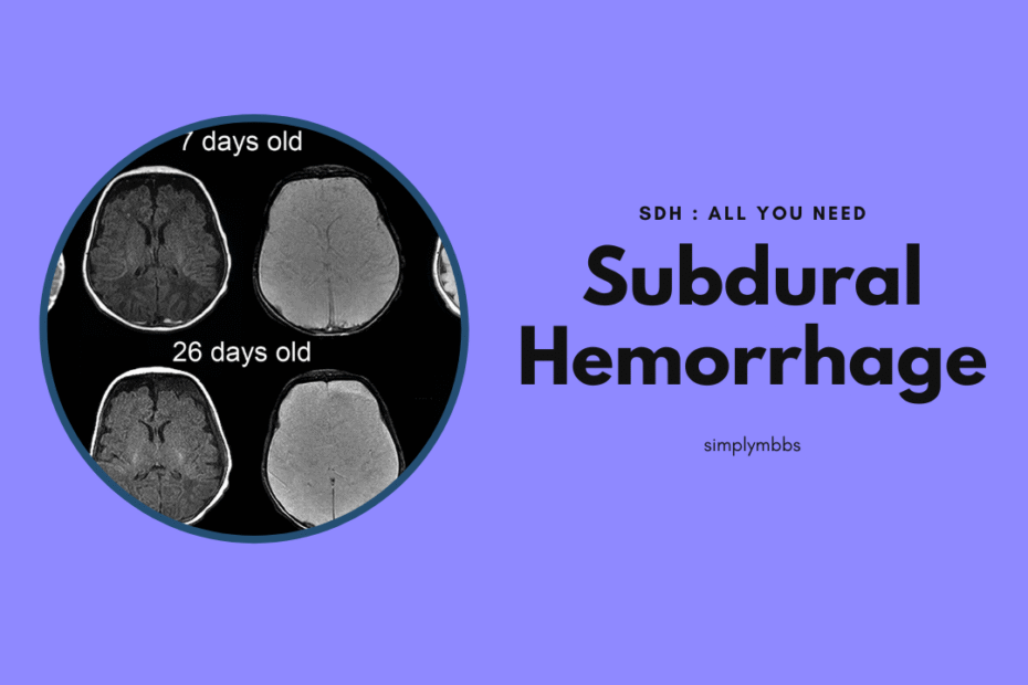 subdural hemorrhage sdh subdural hemorrhage subdural hemorrhage icd 10 hemorrhage subdural ct subdural hemorrhage subdural hemorrhage ct images epidural vs subdural hemorrhage icd 10 code for subdural hemorrhage subarachnoid hemorrhage vs subdural hematoma subdural vs subarachnoid hemorrhage difference between epidural and subdural hemorrhage epidural hemorrhage vs subdural hemorrhage nursing diagnosis for subdural hemorrhage subdural vs epidural hemorrhage epidural and subdural hemorrhage resumption anticoagulation after subdural hemorrhage spinal subdural hemorrhage subdural hemorrhage nursing diagnosis epidural hemorrhage vs subdural subdural hematoma vs subarachnoid hemorrhage