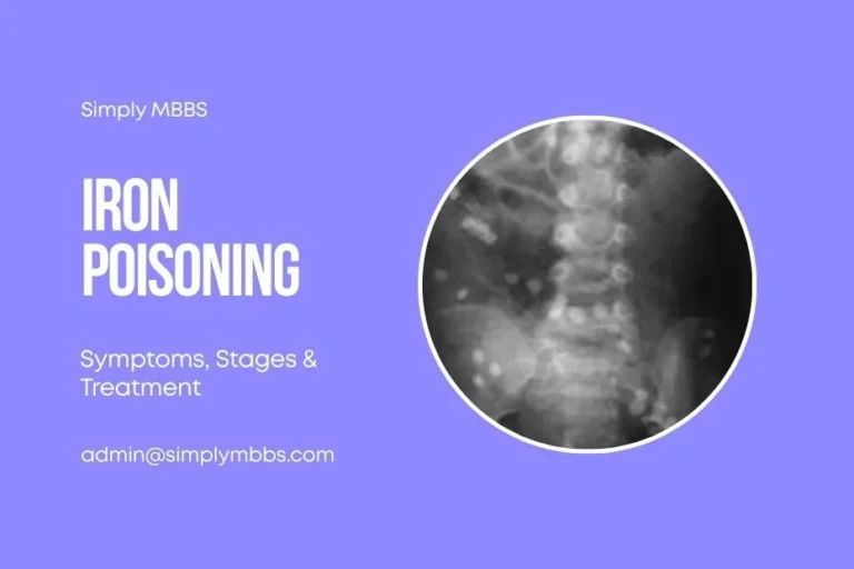 Iron-Poisoning