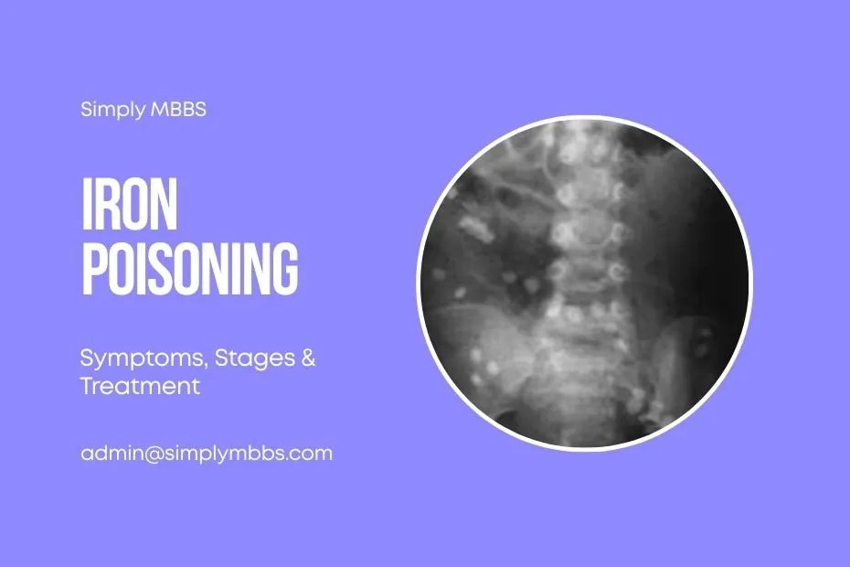 Iron-Poisoning