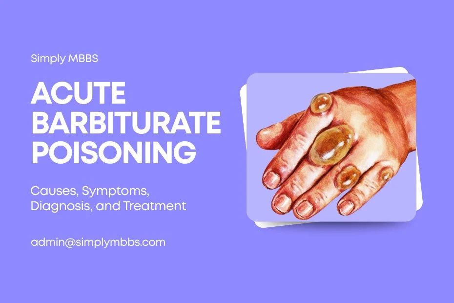 acute-barbiturate-poisoning-meaning