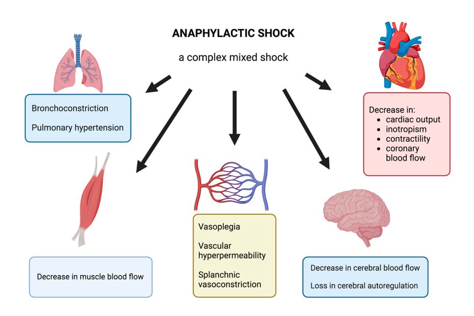 anaphylactic-shock-icd-10