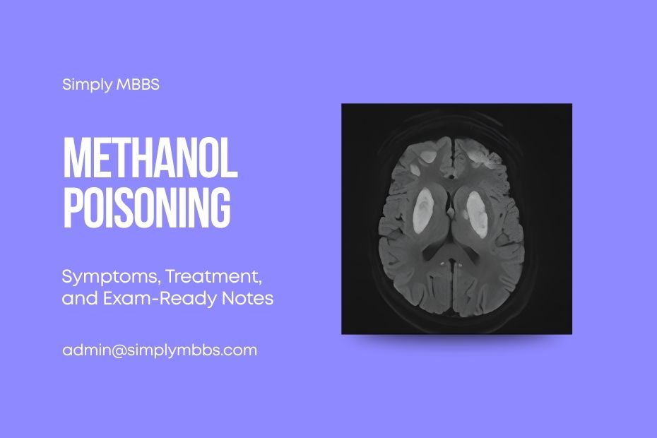 methanol-poisoning-treatment