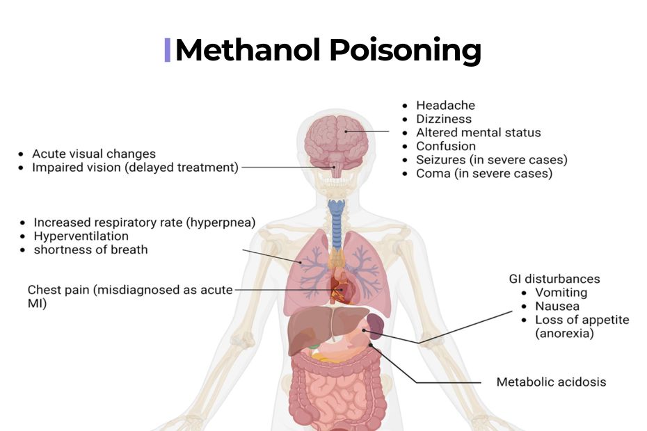 methanol-poisoning
