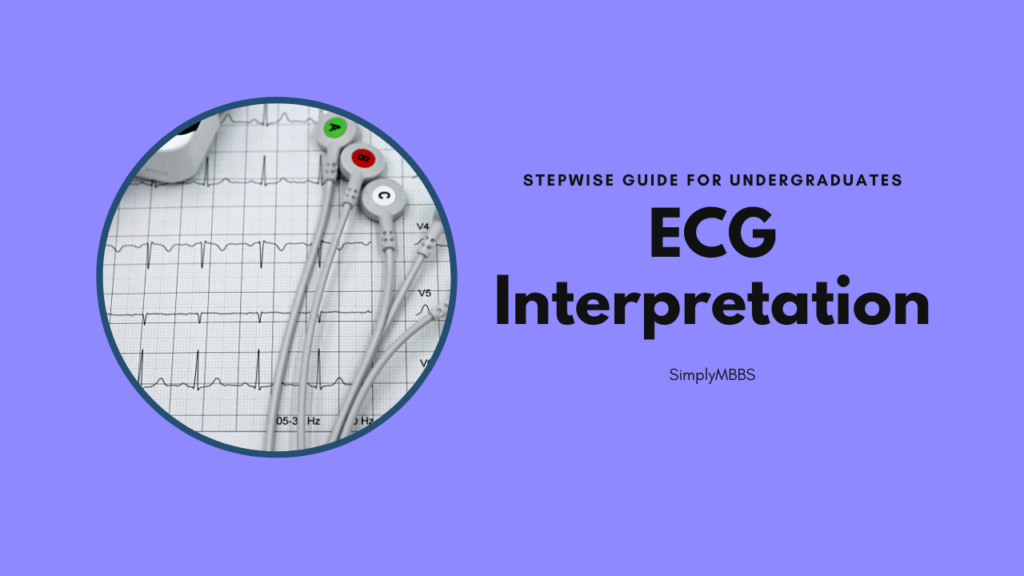ecg interpret