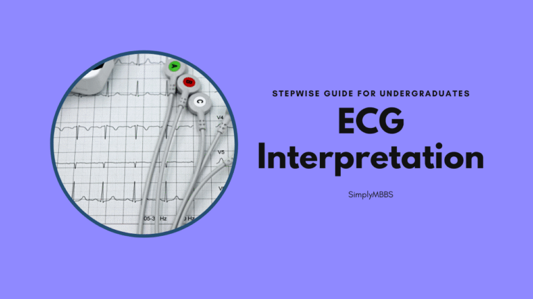 ecg interpret