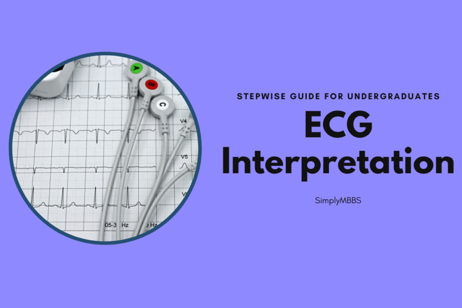 ecg interpret